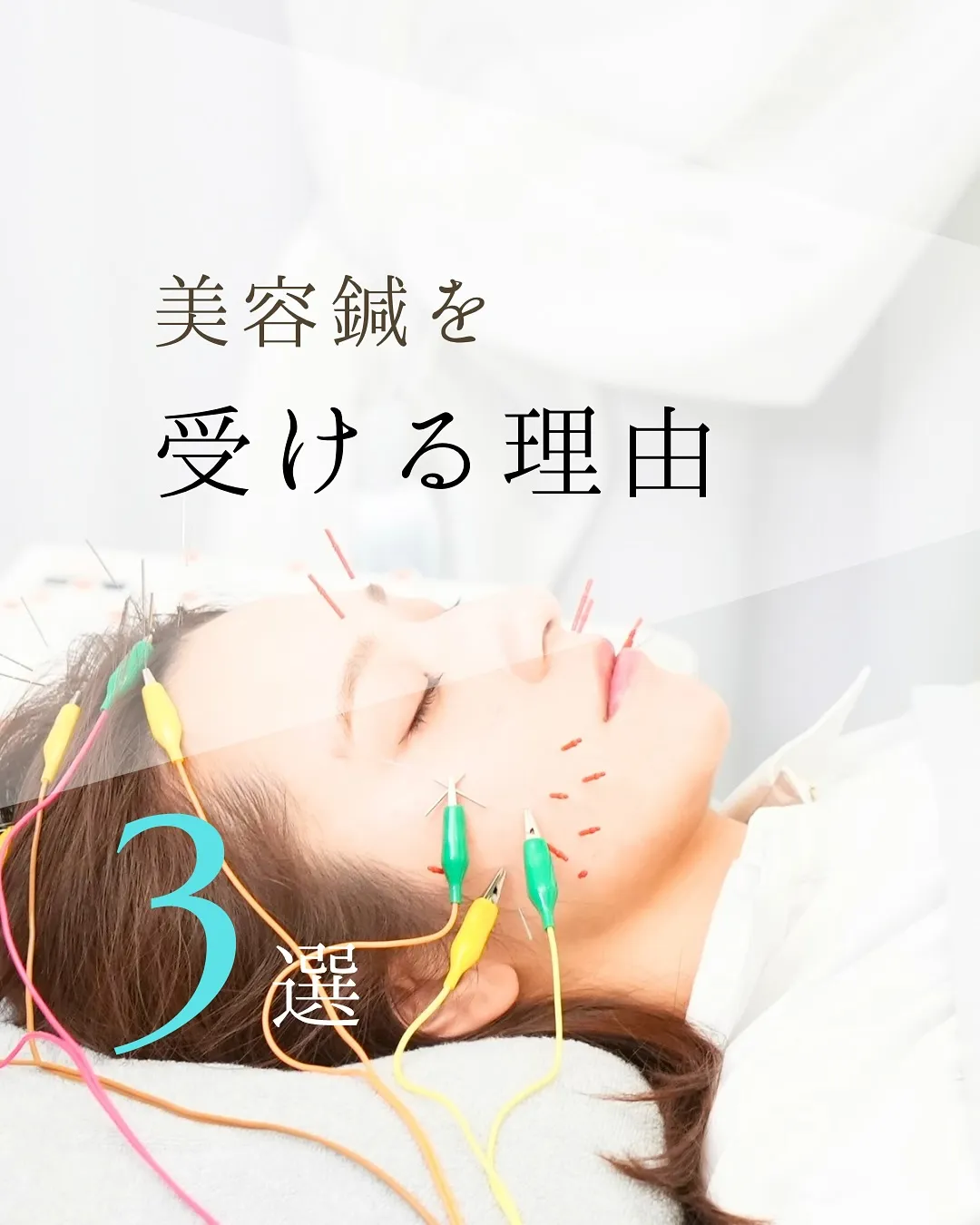 美容鍼を受ける３つの理由