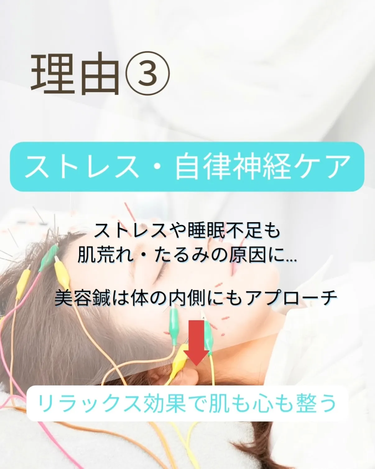 \美容鍼って、なんで人気なの?🪡✨/