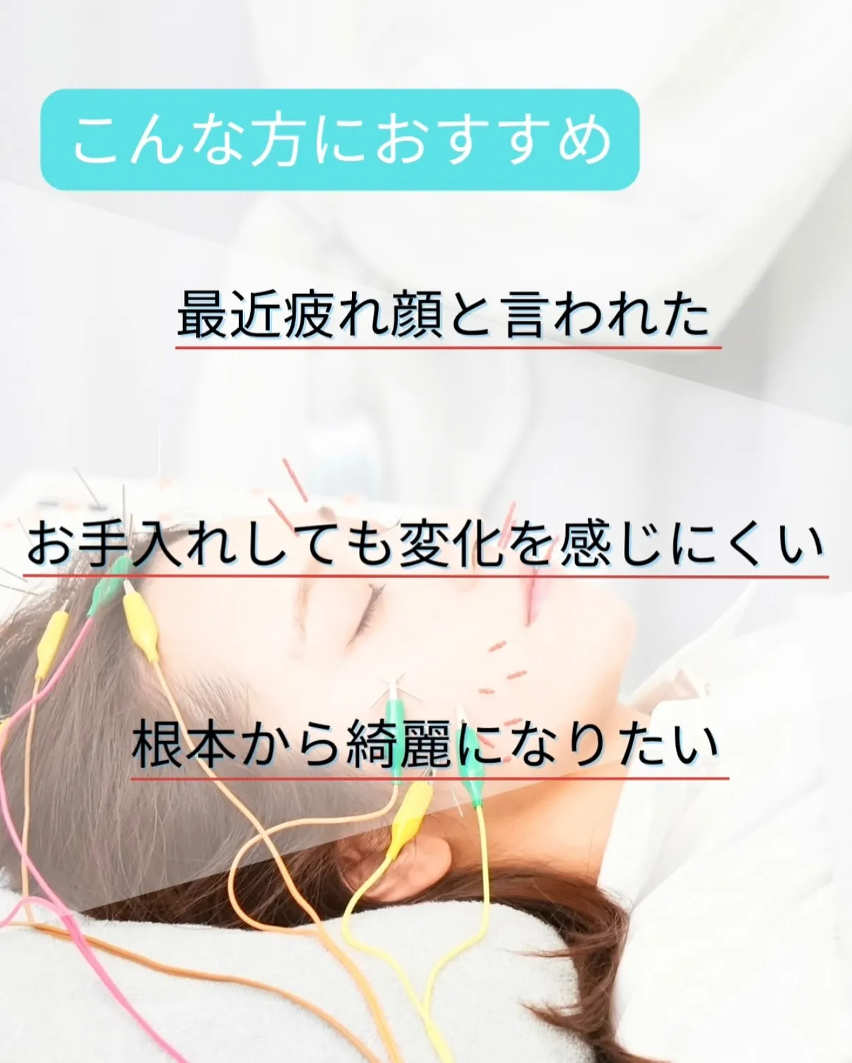 \美容鍼って、なんで人気なの?🪡✨/