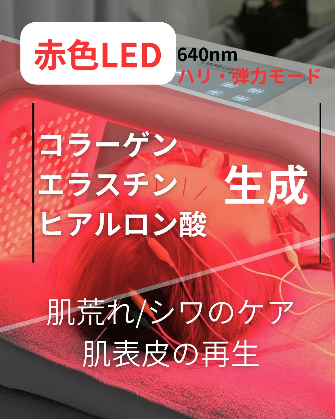 【韓国LED “omega PDT”で肌質改善】