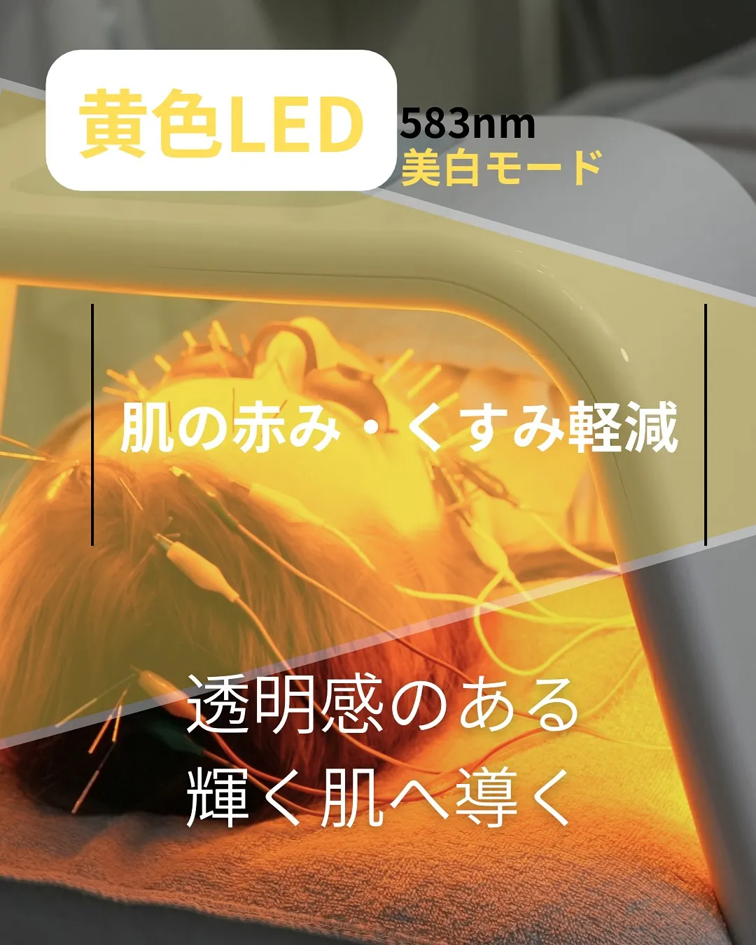 【韓国LED “omega PDT”で肌質改善】