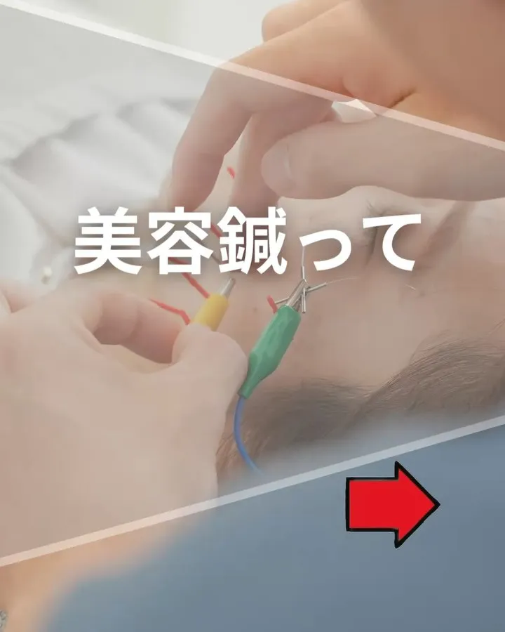 美容鍼って「痛そう…」って