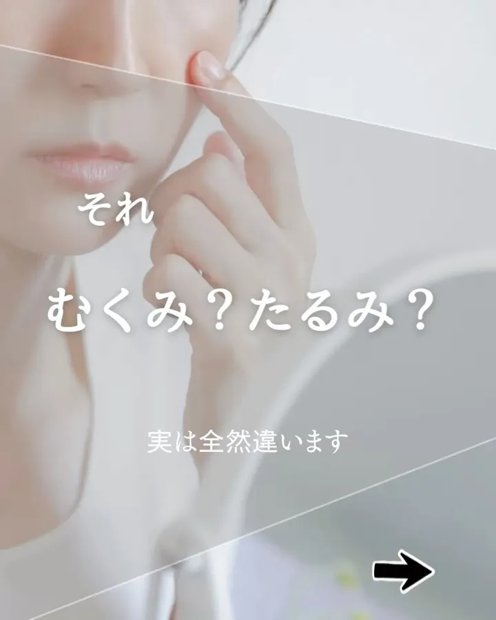 むくみやと思ってたら、たるみやった。