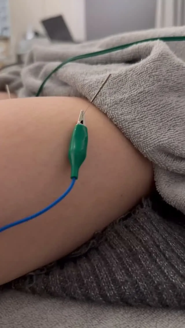 25時間立ち仕事勤務女子に施術！！